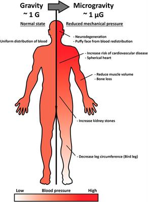 Mechanobiological Implications of Cancer Progression in Space